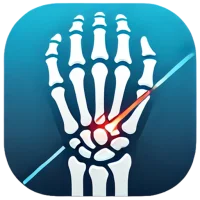FractureX Wrist X-Ray Detector